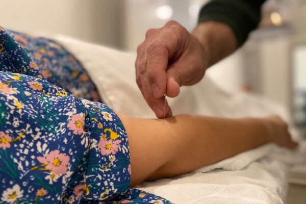 Effektiv Smertelindring med Akupunktur: Din Guide til Bedre Helbred
